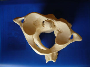 Le désalignement de l'Atlas Le désalignement de l'Atlas